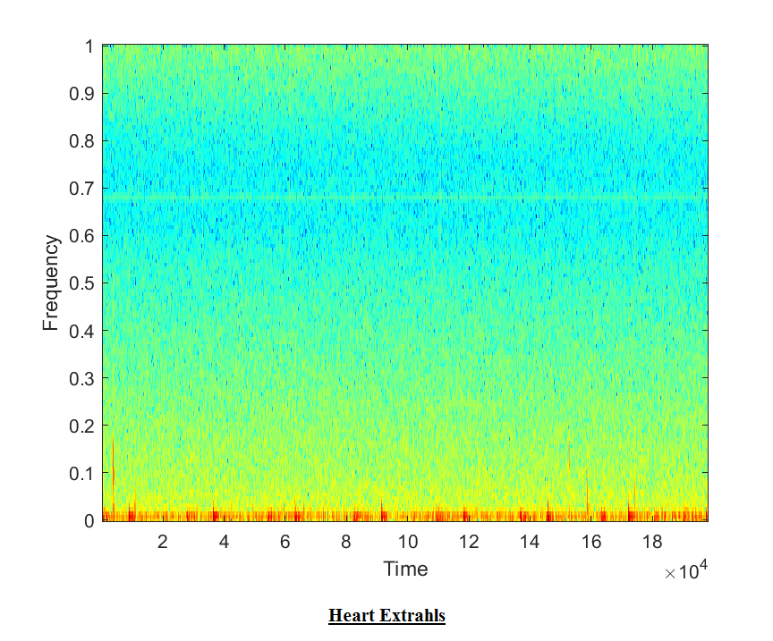 Heart Sound detection